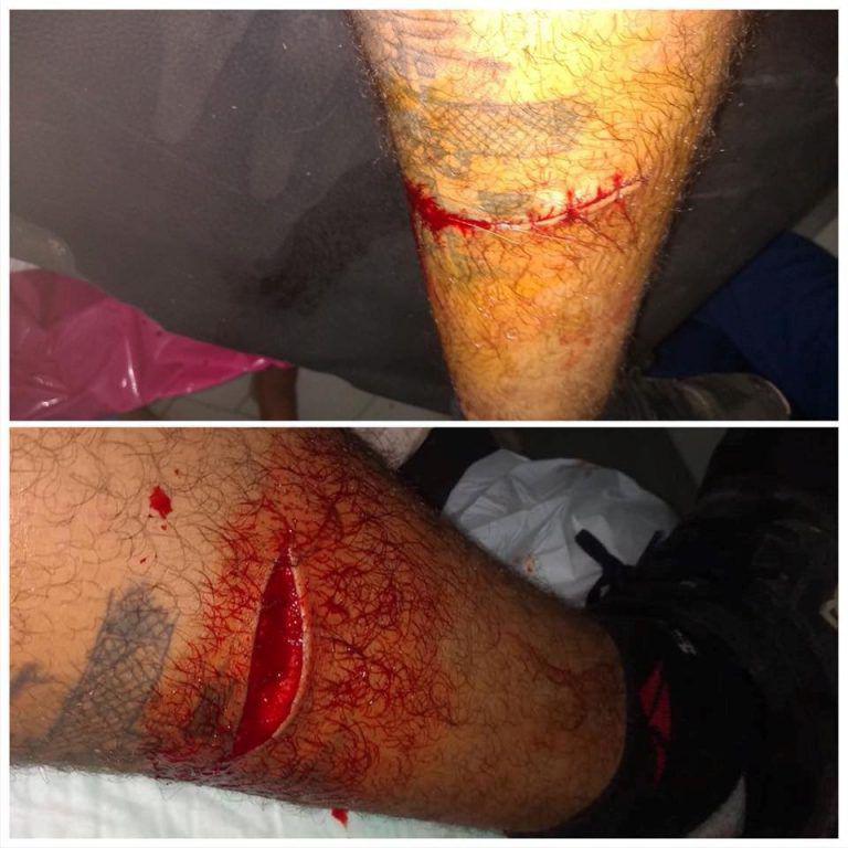 HFSTGNZSGU3TQOLBHA3DIYRZMY