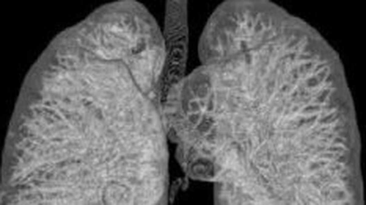 XW2V3YDPQZGVDDKAKWNCDN3XA4